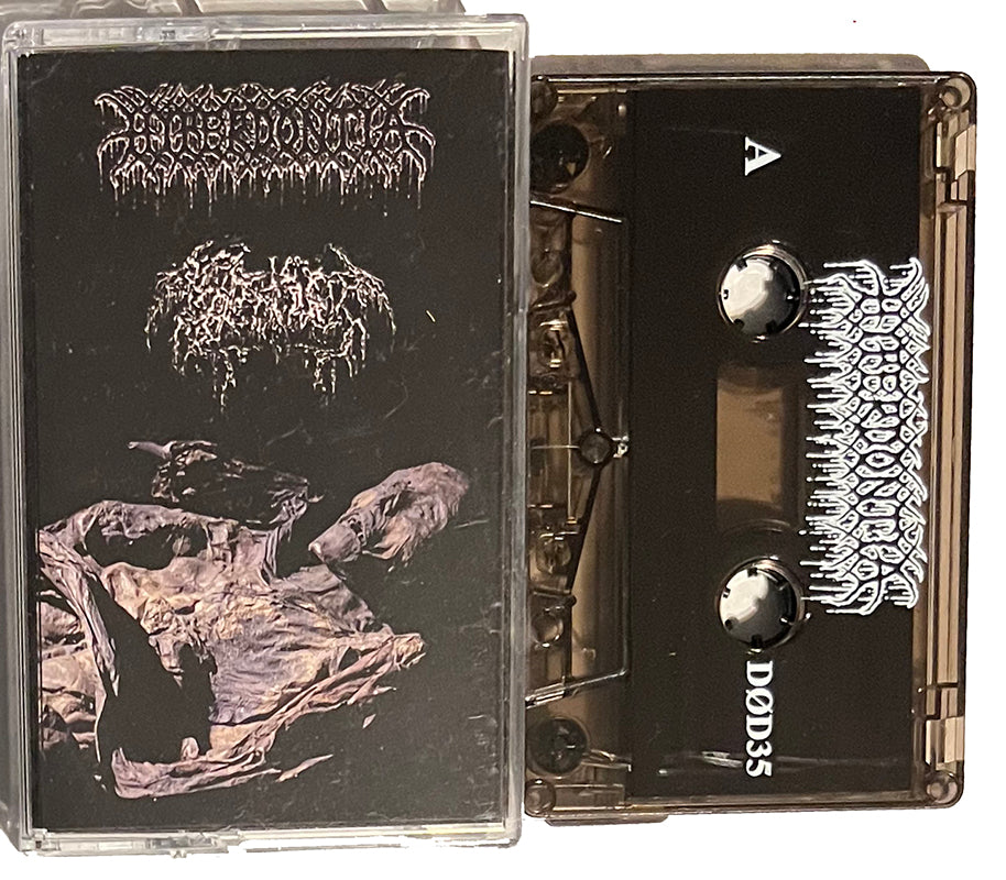 Hyperdontia Septage Cassette split  Tape
