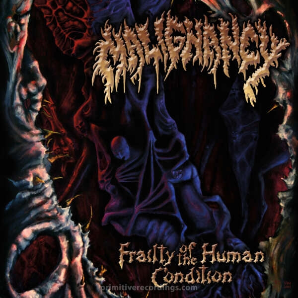 Malignancy  " Frailty of the Human Condition "  CD