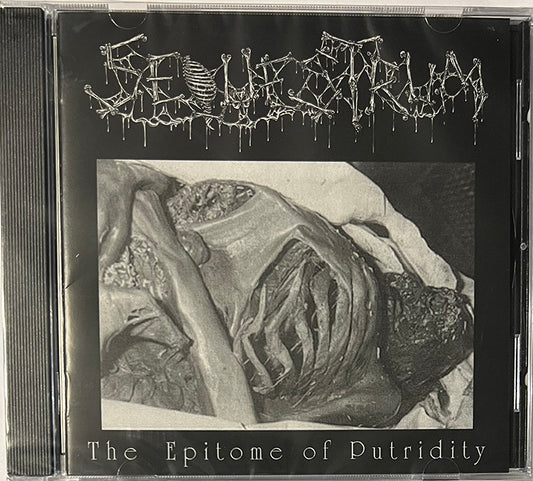 Sequestrum " The Epitome of Putridity "  MCD