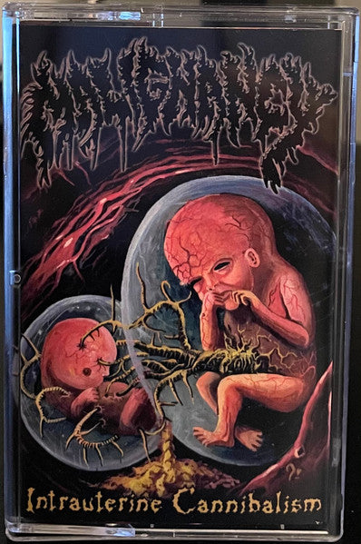 Malignancy " Intrauterine Cannibalism " Cassette Tape rare limited to 50