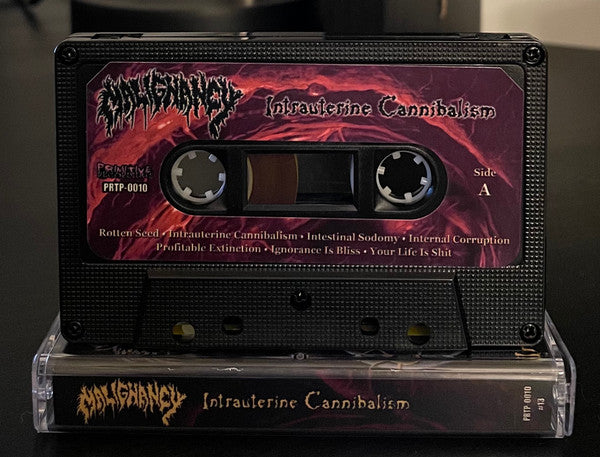 Malignancy " Intrauterine Cannibalism " Cassette Tape Mortician death metal 