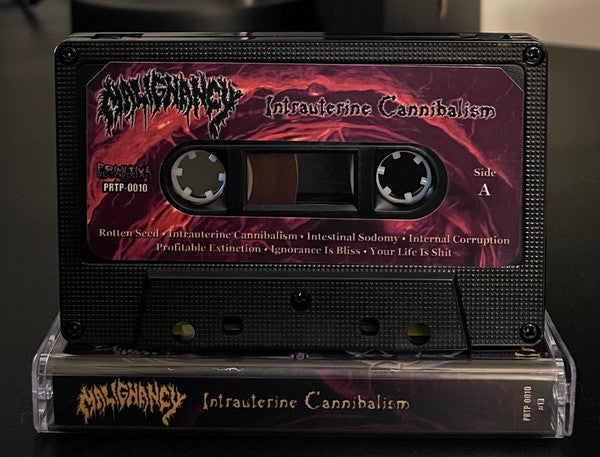 Malignancy " Intrauterine Cannibalism " Cassette Tape Mortician death metal 